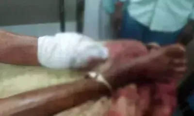 bundi में दिल दहला देने वाली घटना   बुजुर्ग महिला का पैर काटकर चांदी के कड़े ले गए बदमाश