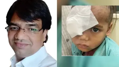 3 साल के बच्चे की आंख में जा घुसा कीड़ा  ऑपरेशन हुआ तो जिंदा बाहर निकला