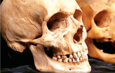 मिली 3 लाख साल पुरानी खोपड़ी   इंसानों की नई प्रजाति की खोज संभव